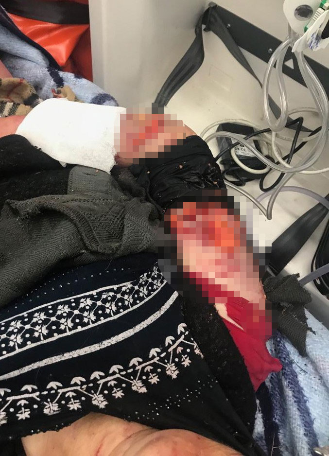 Kayseri'den sonra Kırşehir'de köpek saldırısı
